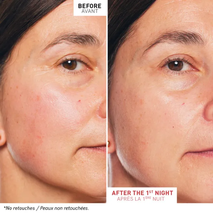 Skin Therapy Night Oil-Serum