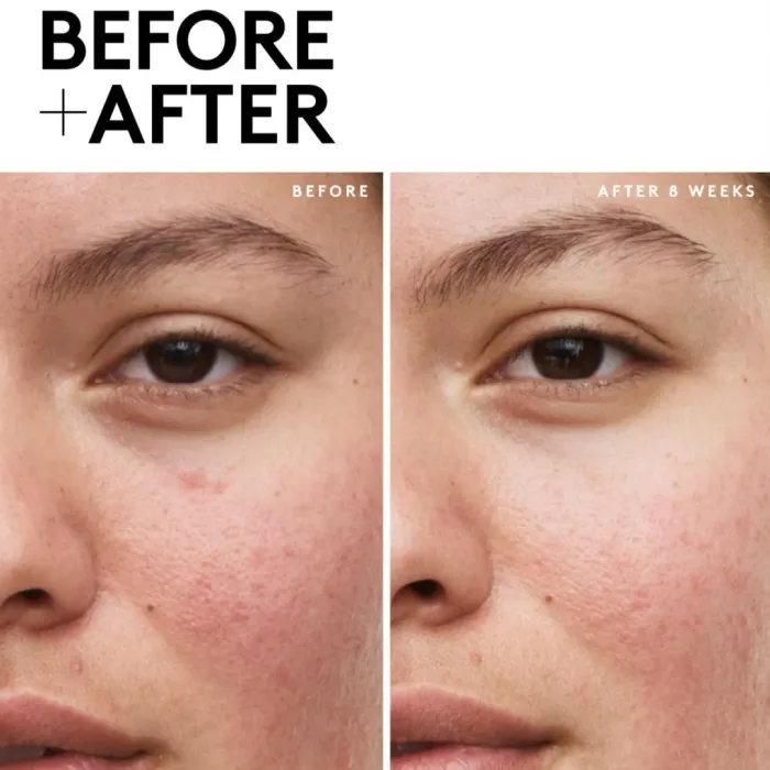 Fenty Skin Travel-Size Start'r Set with Mineral SPF: Dry Skin Edition