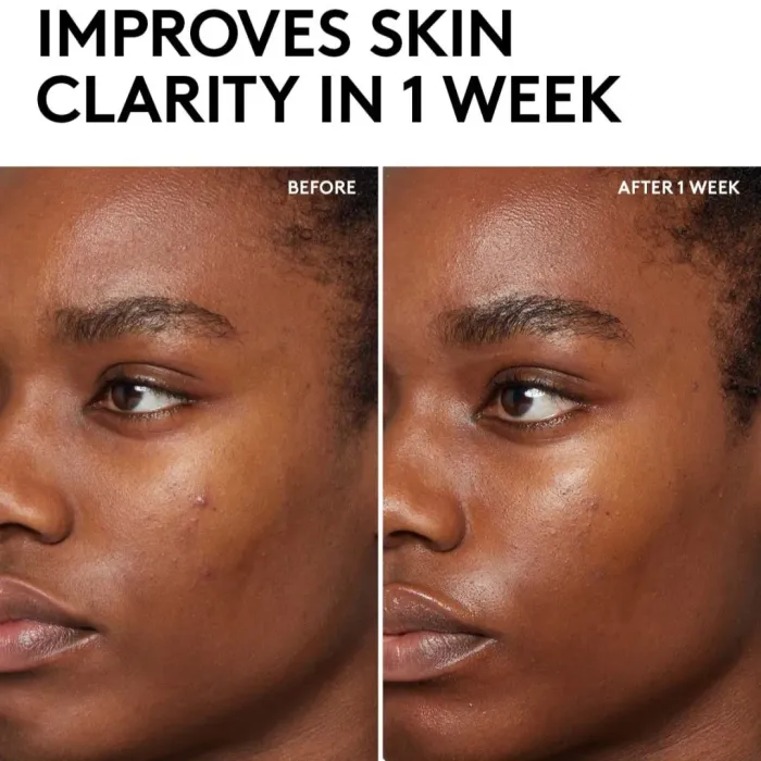 Cherry Dub BHA Toner with Salicylic Acid + Aloe Juice