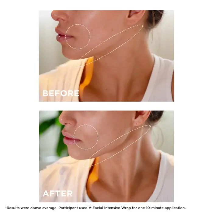 V-Facial Intensive Wrap Depuffing Face Mask