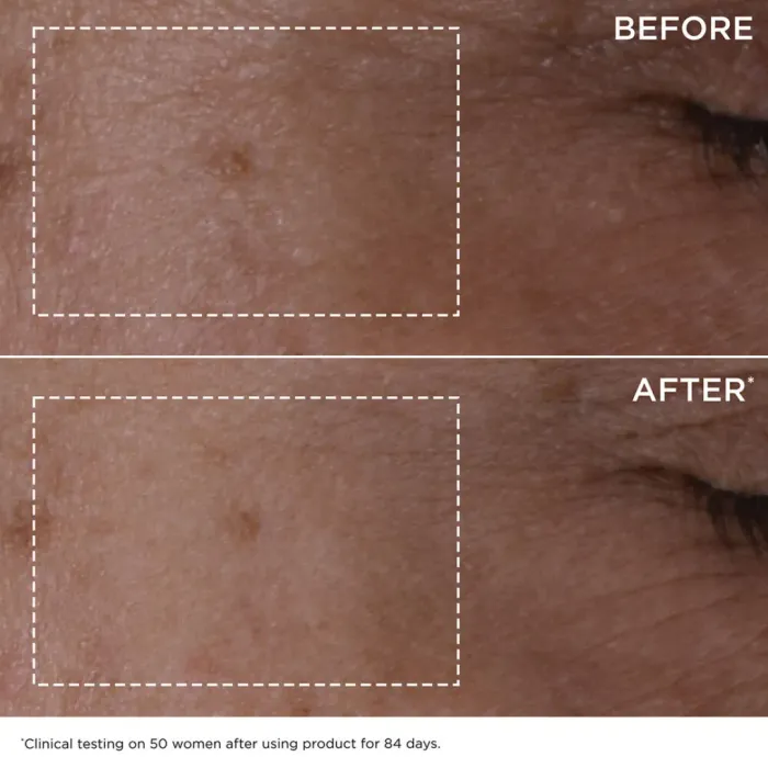 Double Serum + Double Serum Eye Duo