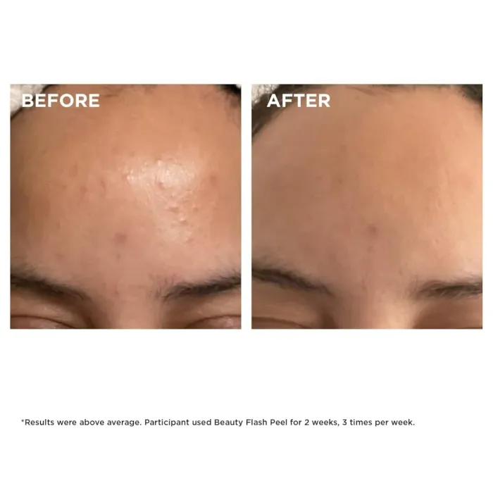 Beauty Flash Peel Face Exfoliator