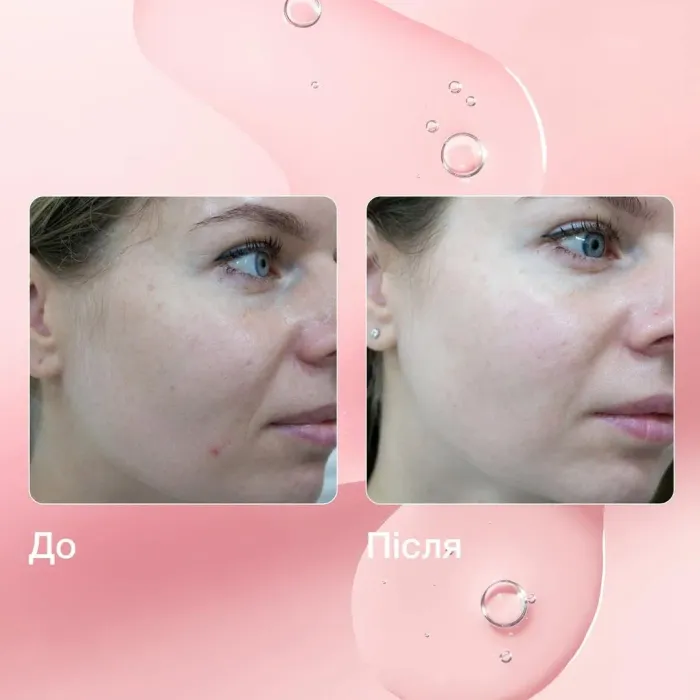 Gentle Peel Lactic Acid Serum