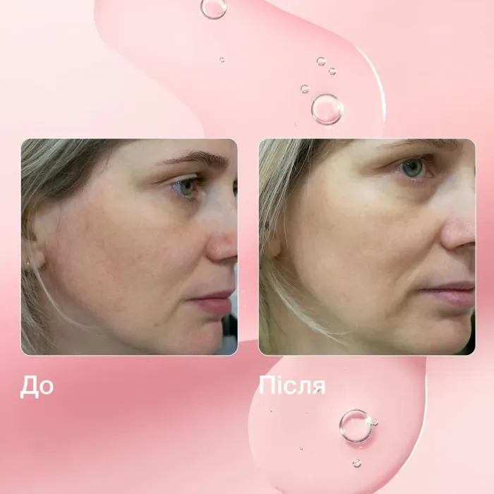 Gentle Peel Lactic Acid Serum