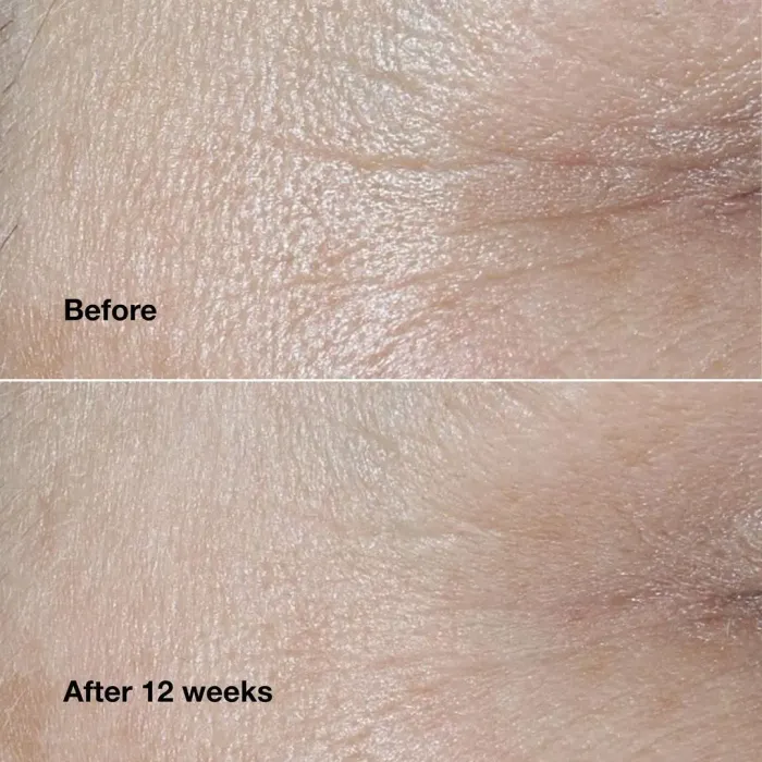 Clinique Smart Clinical Repair™ Wrinkle Correcting Cream