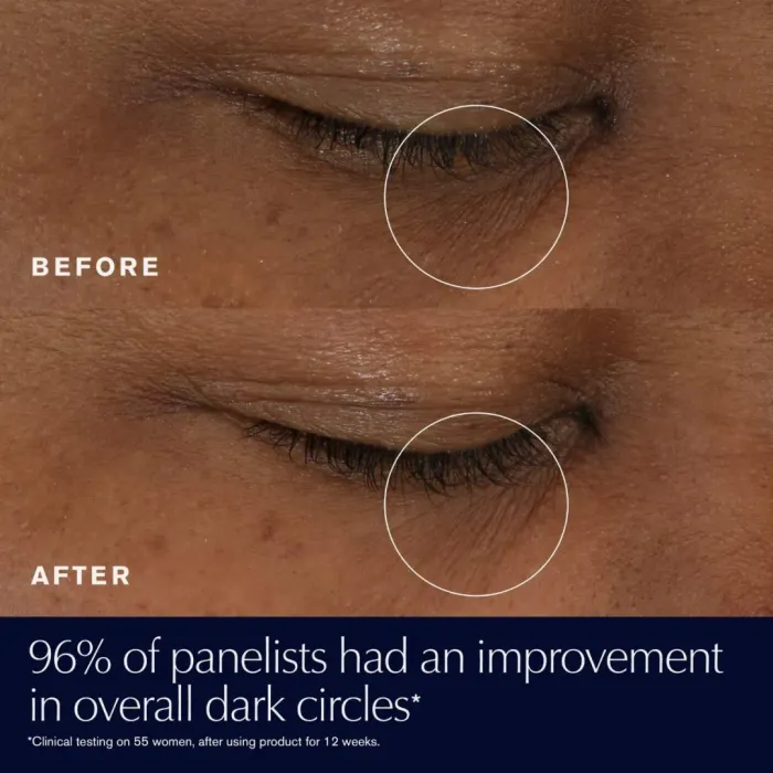 Advanced Night Repair Eye Supercharged Gel-Creme Synchronized Multi-Recovery Eye Cream