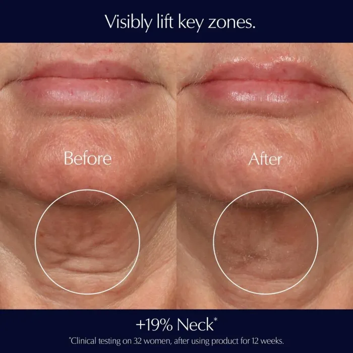 Perfectionist Pro Rapid Firm + Lift Serum with Hexapeptides 8 + 9