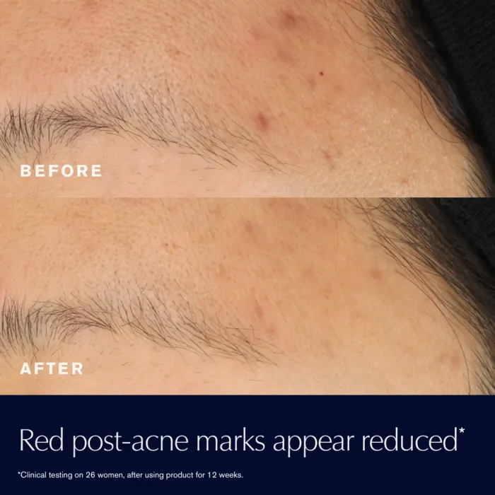 Advanced Night Repair Rescue Solution Serum with 15% Bifidus Ferment
