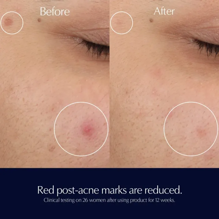 Advanced Night Repair Rescue Solution Serum with 15% Bifidus Ferment