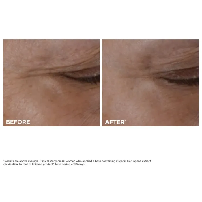 Total Eye Lift Refillable Eye Cream