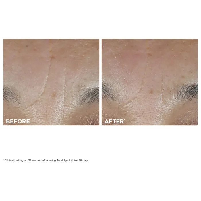Total Eye Lift Refillable Eye Cream