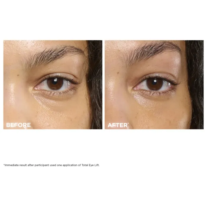 Total Eye Lift Refillable Eye Cream