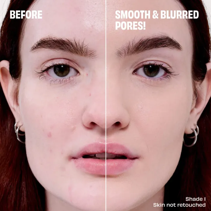 The Porefessional Foundation