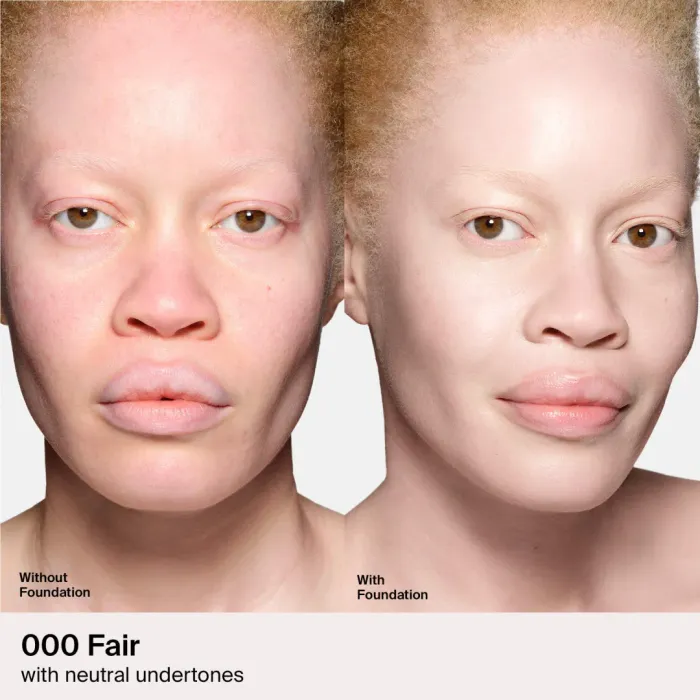 Triclone™ Skin Tech Medium Coverage Foundation