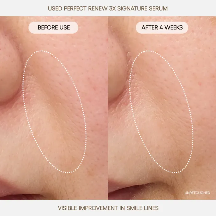 Perfect Renew 3X Signature Serum