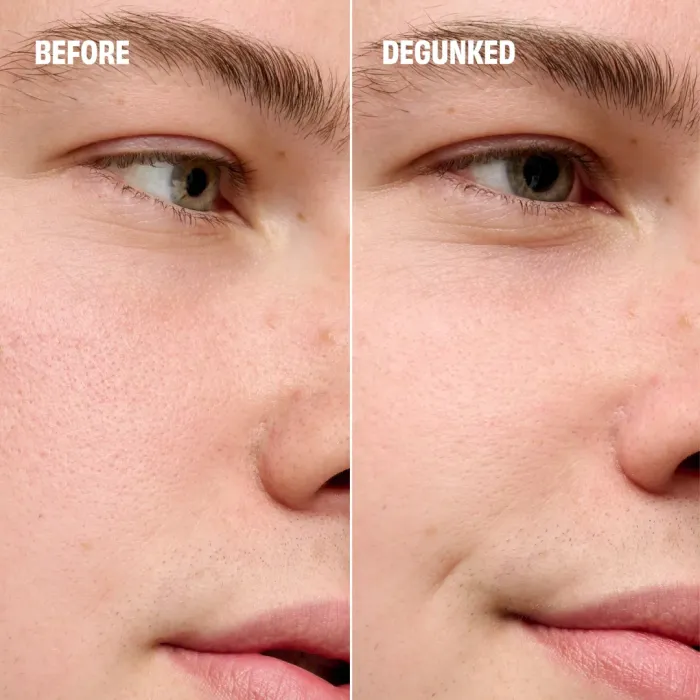 The Porefessional Degunker