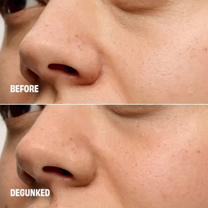 The Porefessional Degunker