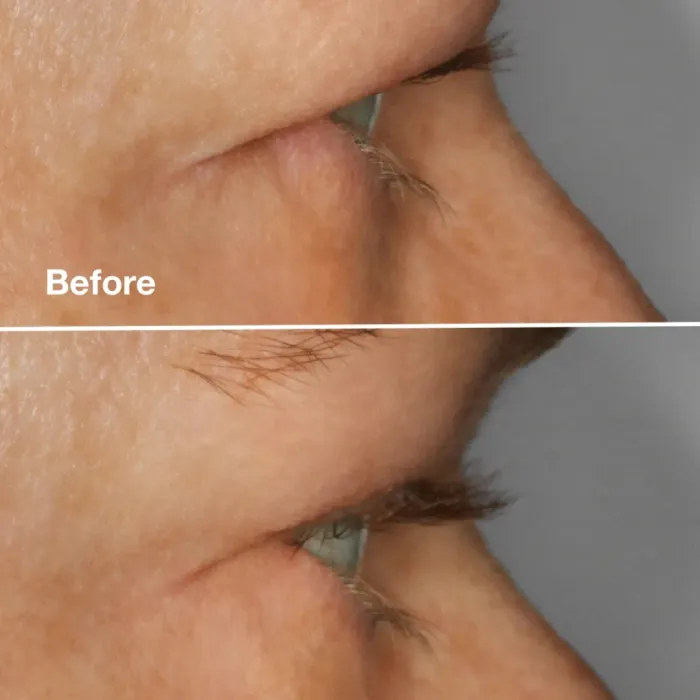 High Impact™ Lash Amplifying Serum